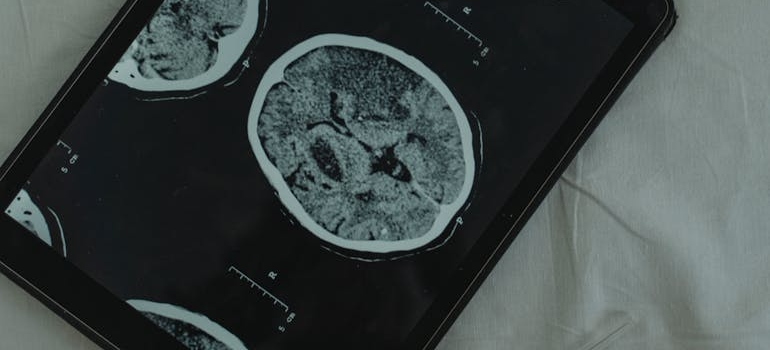 An image of the brain